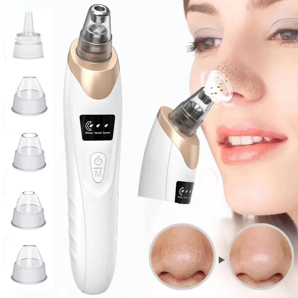 5-in-1 Blackhead Remover: Vacuum Acne & Spot Cleaner