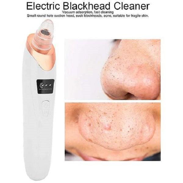 5-in-1 Blackhead Remover: Vacuum Acne & Spot Cleaner