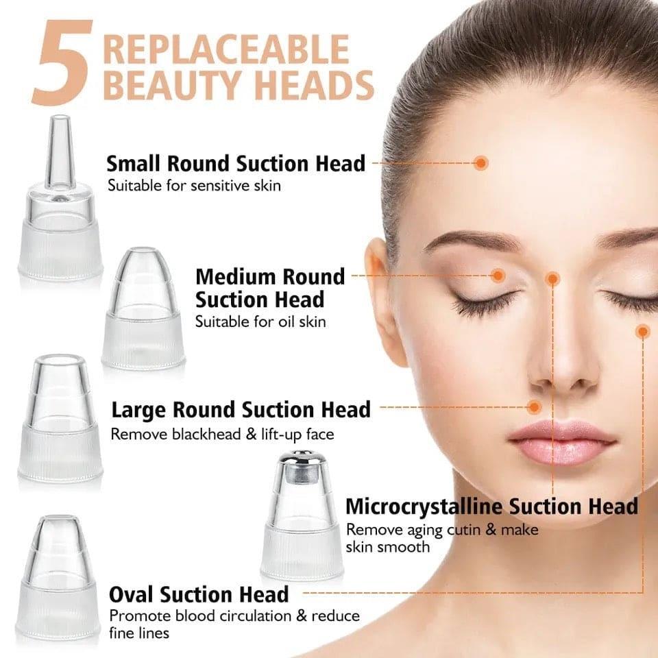 5-in-1 Blackhead Remover: Vacuum Acne & Spot Cleaner